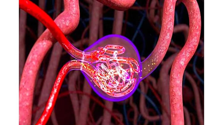 Glomerulonefritis